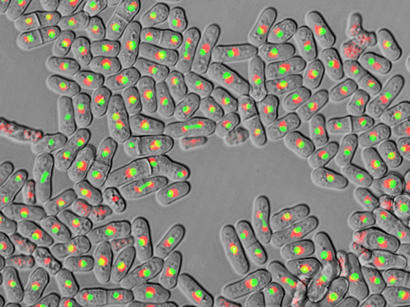 alt: Buňky poltivé kvasinky v optickém mikroskopu. Foto Martin Převorovský.
