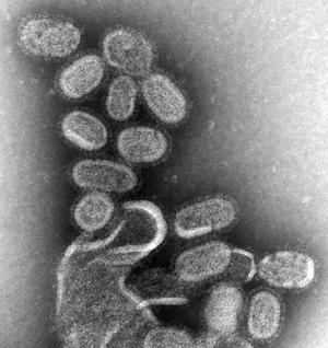 alt: Částice chřipkového viru. Snímek z elektronového mikroskopu. Zdroj Wikimedia Commons / Centers for Disease Control and Prevention, autoři Cynthia Goldsmith, CDC / Dr. Terrence Tumpey. Volné dílo (public domain).