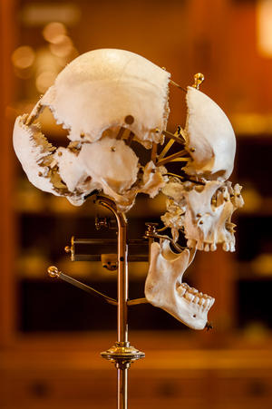 alt: Takzvaná Beauchênova preparace lebky. Všechny lebeční kosti jsou přehledně oddělené, jsou ovšem zachovány jejich prostorové vztahy. Foto Petr Jan Juračka.