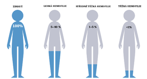 alt: Obr. 1 - Procentuální přítomnost srážecích faktorů v souvislosti se závažností hemofilie. Upraveno, zdrojový obrázek: http://www.alnylam.com/wp-content/uploads/2017/04/Hemophilia2.png