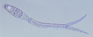 alt: Cerkárie ptačí schistosomy (zde Trichobilharzia franki z uchatky nadmuté) jsou typické dvěma pigmentovanými očními skvrnami a na konci rozdvojeným ocáskem.