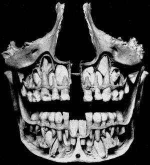 alt: Vývoj trvalého chrupu probíhá v tělech čelistí. Zdroj Wikimedia Commons, H. Gray 1918, volné dílo