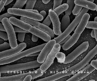 alt: Bakterie Escherichia coli, jedna z obyvatelek našich střev. Snímek pořízený elektronovým mikroskopem. Zdroj Wikimedia Commons, kredit Rocky Mountain Laboratories, NIAID, National Institutes of Health.