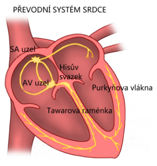 alt: Obrázek 1. Převodní systém srdce. Zdroj Wikiskripta, autor Icewalker, licence Creative Commons Uveďte autora 3.0 Česko. Popisky František Vyskočil.