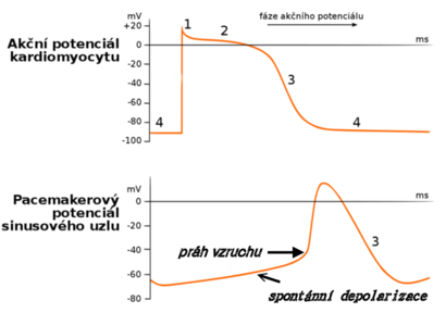 alt: Obrázek 2. Časový průběh potenciálů v srdci. Zdroj Wikiskripta, autor Icewalker, licence Creative Commons Uveďte autora 3.0 Česko. Popisky v dolním grafu František Vyskočil.