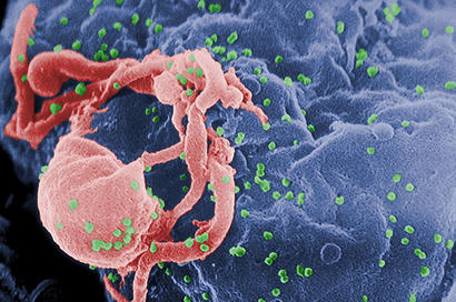 alt: Částice viru HIV (zeleně) vytvářející se na povrchu lymfocytu. Počítačově obarvený snímek z rastrovacího elektronového mikroskopu. Zdroj Wikimedia Commons / CDC Public Health Image Library, autor C. Goldsmith, poskytli CDC / C. Goldsmith, P. Feorino, E. L. Palmer, W. R. McManus. Volné dílo (public domain).