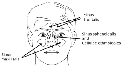 alt: Vedlejší nosní dutiny. Zdroj Wikimedia Commons, volné dílo.