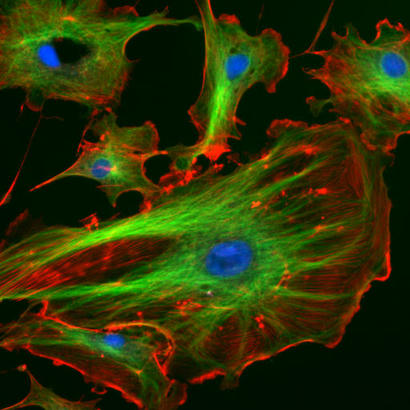 alt: Cytoskelet je tvořen několika typy bílkovinných vláken. Na snímku živočišných buněk jsou označeny dvě složky cytoskeletu: zeleně mikrotubuly, červeně mikrofilamenta. Modře jsou obarvena buněčná jádra. Zdroj Wikimedia Commons / http://rsb.info.nih.gov/ij/images, volné dílo / public domain.