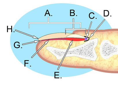 alt: Anatomická stavba nehtu. A: nehtová ploténka, B: lunula, C: kořen nehtu, D: sinus (zářez), E: nehtová matrix, F: nehtové lůžko, G: hyponychium, H: volný okraj. Zdroj Wikimedia Commons, autor KDS444, licence Creative Commons Attribution-Share Alike 3.0 Unported.