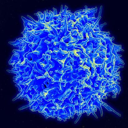 alt: Lidský T-lymfocyt. Počítačově obarvený snímek z rastrovacího elektronového mikroskopu. Zdroj Wikimedia Commons, autor NIAID/NIH (http://www.niaid.nih.gov/), volné dílo / public domain.