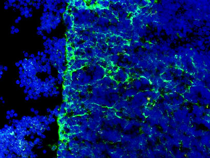 alt: Vnitřní uspořádání brzlíku. Zeleně je obarvena tkáň tvořená epiteliálními buňkami, která se během života zmenšuje a je zčásti nahrazena tkání tukovou. Modře jsou označena jádra buněk, hlavně T-lymfocytů. Foto archiv Jana Černého.