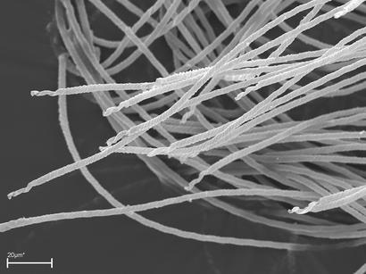alt: Spermie dnešní australské lasturnatky * Mytilocypris mytiloides*. Foto Renate Matzke-Karasz.