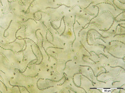 alt: Mikroskopický snímek sinic z rodu *Nostoc*. Zdroj Wikimedia Commons, autor © Gibon, copyrighted free use.