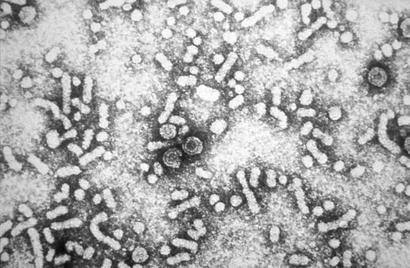 alt: Virus hepatitidy B může být v zaschlé krvi „naživu“ dosti dlouho. Zdroj Wikimedia Commons / CDC-PHIL, volné dílo.