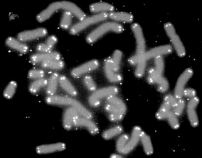 alt: Lidské chromozomy. Světlé tečky jsou telomery na jejich koncích. Zdroj Wikimedia Commons, autor U.S. Department of Energy Human Genome Program, volné dílo / public domain.