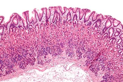 alt: Příčný řez žaludeční sliznicí. Barvený mikroskopický preparát. Zdroj Wikimedia Commons, autor Nephron, licence CC BY-SA 3.0.