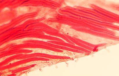 alt: Protáhlé sklereidy (červeně obarvené) v listu rostliny *Dionysia kossinskyi*. Zdroj Wikimedia Commons, autor IdaBokmal, úpravy Jan Kolář, licence CC BY-SA 3.0.
