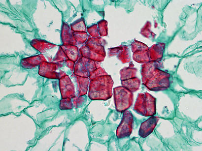 alt: Skupina sklereid (obarveny červenofialově) z plodu hrušně. Zdroj Flickr.com, autor BlueRidgeKitties, úpravy Jan Kolář, licence CC BY-NC-SA 2.0.