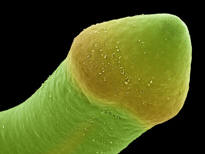 alt: Jednoduchá hlavička tasemnice rodu *Atractolytocestus*, jak ji můžeme vidět ve skenovacím elektronovém mikroskopu (počítačově obarveno).