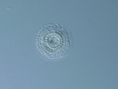 alt: Jednobuněčný parazit brousilka (*Trichodina*) s věncem brv rozmístěných pravidelně po celém obvodu kruhovitého těla.
