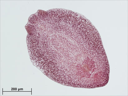 alt: Trvalý preparát larvy motolice rodu *Diplostomum*, která byla vyňata z oční čočky ryby. Jinak světlá motolice byla před vytvořením preparátu červeně obarvena.