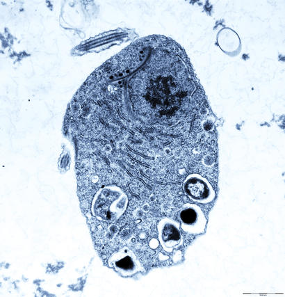 alt: Oxymonáda rodu *Monocercomonoides*, snímek z transmisního elektronového mikroskopu.