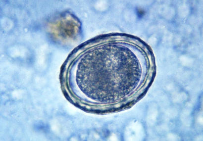 alt: Oplodněné vajíčko škrkavky dětské. Zdroj Wikimedia Commons, autor CDC / Dr. Mae Melvin, úpravy Jan Kolář, volné dílo / public domain.