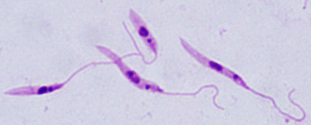 alt: Bičíkatá forma ničivky útrobní (*Leishmania donovani*) zvaná promastigot. Foto: Jovana Sádlová.