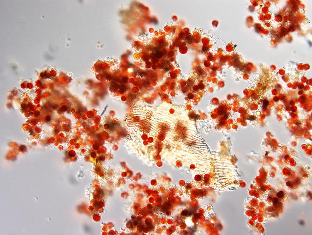 alt: Mikroskopický snímek řas, které zbarvují do červena sníh na krkonošských hřebenech. Foto Linda Nedbalová.
