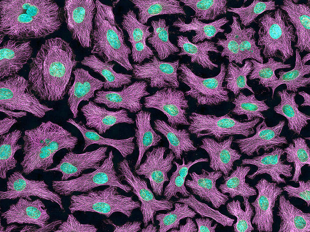 alt: Ilustrační foto: Lidské nádorové buňky linie HeLa, pěstované v buněčné kultuře. Světle modře je obarvena DNA v jádrech, fialově síť bílkovinných vláken zvaných mikrotubuly. Zdroj Wikimedia Commons, autor National Institutes of Health (NIH), volné dílo / Public Domain.
