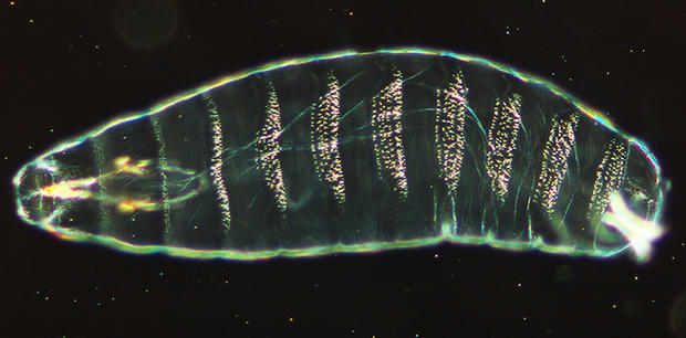 alt: Embryo octomilky v pozdější fázi vývoje, kdy už je rozlišena hlavová část (*vlevo*) a část zadečková. Zdroj Wikimedia Commons, autor Nina, úpravy Jan Kolář, licence CC BY-SA 3.0.