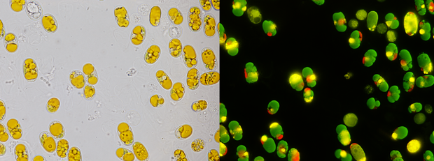 alt: Mikrofotografie buněk Vischeria sp. v běžném světle (vlevo) a fluorescenční: zeleně svítí lipidová tělíska, červeně chlorofyl v plastidech. Tyto řasy se často používají k produkci biopaliv, neboť mají velmi vysoký obsah tuků sušině (50-70 %). Foto Jana Pilátová