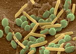 alt:Myxococcus xanthus v elektronovém mikroskopu. Žlutě jsou označené pohyblivé buňky, zeleně spory. Zdroj: Juergen Berger, Supriya Kadam.