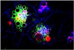 alt: Foto: Buňky HeLa (nádorové buňky adenokarcinomového původu) s vneseným genem pro protein  Rab7-EGFP (zelený signál v lysozómech a pozdních endozómech), opůsobené Vacuolinem-1 a následně inkubované v různých časech s dvěma různě fluorescenčně značenými transferriny (které jsou buňkou pohlcovány a slouží jako zdroj železa).  Autor snímu: doc. RNDr. Jan Černý, Ph.D.