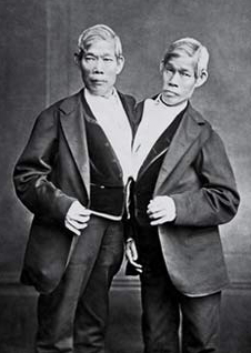 alt: Chang a Eng Bunkerovi (1811–1874). Pocházeli z Thajska, odkud se přestěhovali do USA. Tam se stali velice známými jako „siamská dvojčata“ (Siam je starší název pro Thajsko). Pojmenování se pak vžilo coby obecný termín pro případy srostlých sourozenců. Zdroj Wikimedia Commons, volné dílo.